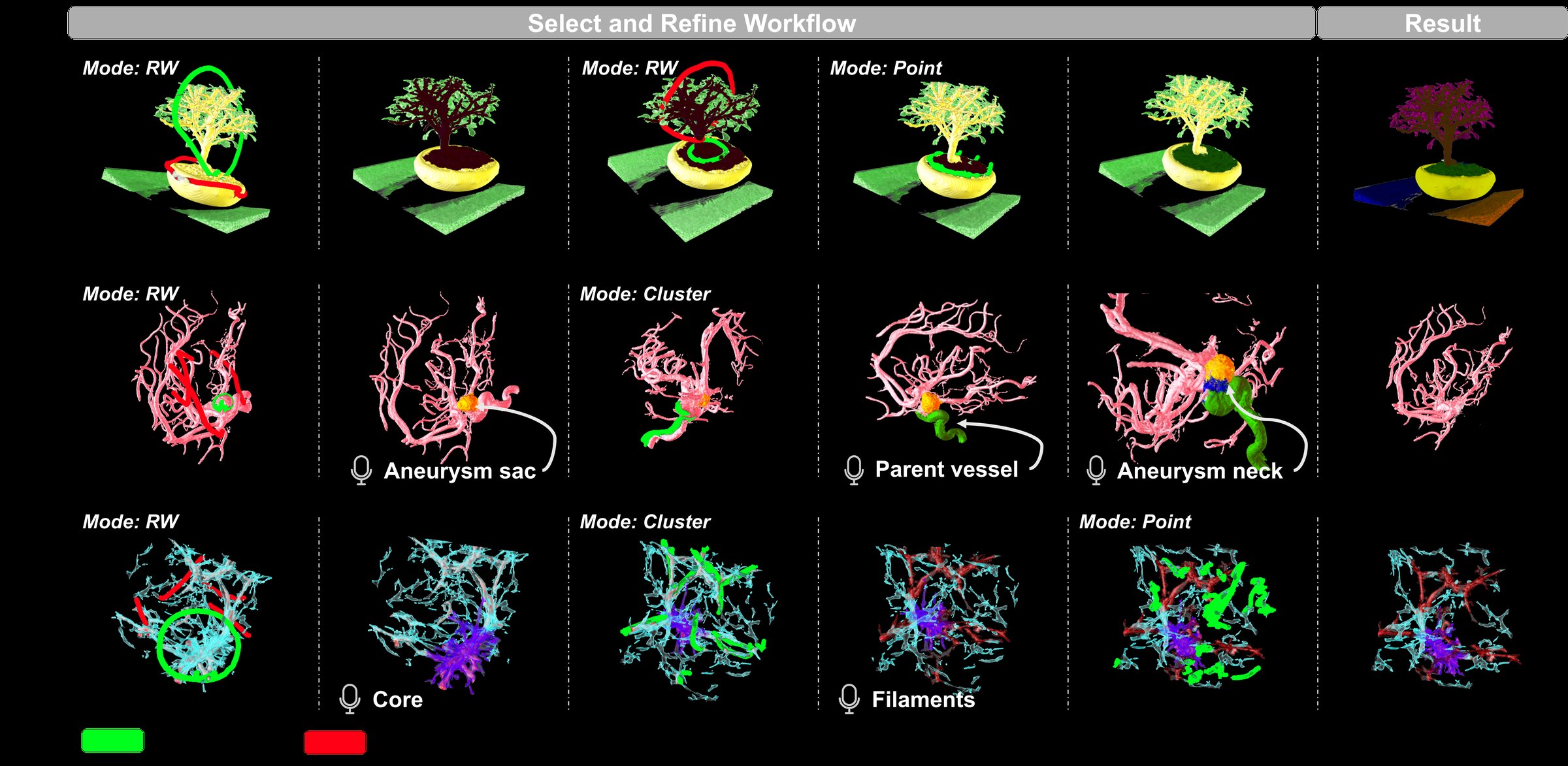 Select-and-refine workflow case studies figure
